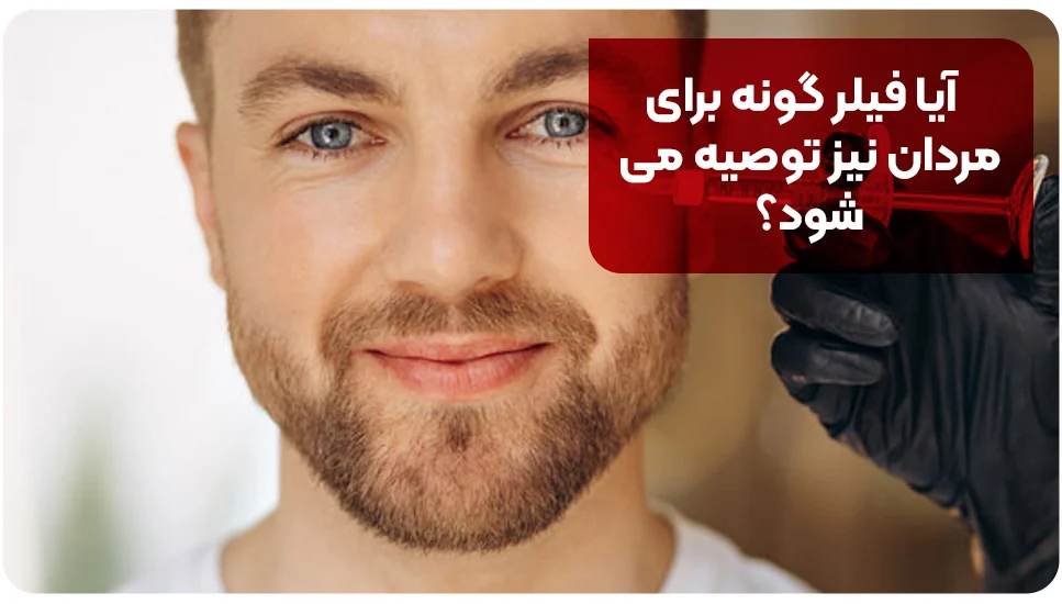 آیا فیلر گونه برای مردان نیز توصیه می شود؟