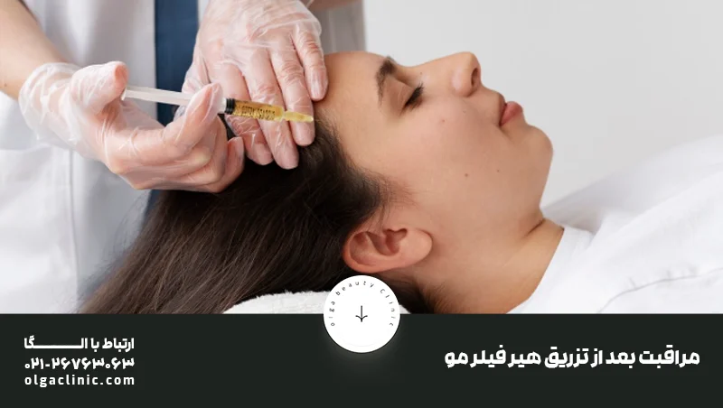 مراقبت بعد از تزریق هیر فیلر مو