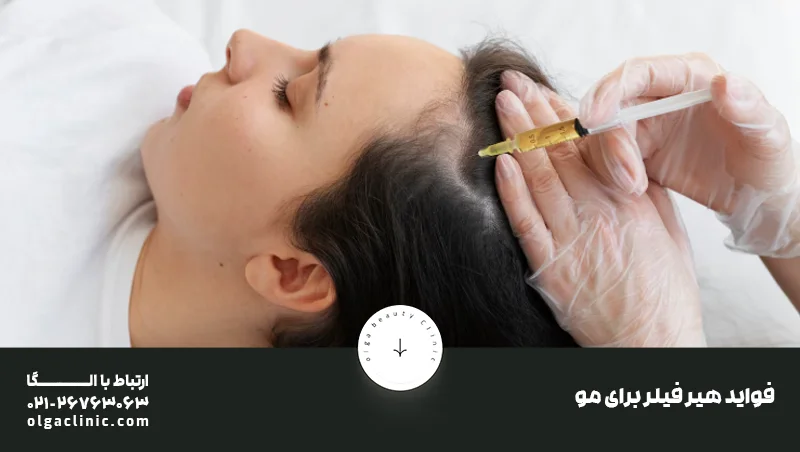 فواید هیر فیلر برای مو